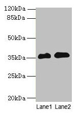 RFPL3 Antibody - Western blot All lanes: RFPL3 antibody at 8µg/ml Lane 1: Human placenta tissue Lane 2: HL60 whole cell lysate Secondary Goat polyclonal to rabbit IgG at 1/10000 dilution Predicted band size: 36, 33 kDa Observed band size: 36 kDa