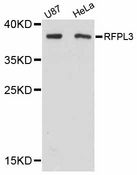 RFPL3 Antibody - Western blot analysis of extracts of various cell lines, using RFPL3 antibody at 1:3000 dilution. The secondary antibody used was an HRP Goat Anti-Rabbit IgG (H+L) at 1:10000 dilution. Lysates were loaded 25ug per lane and 3% nonfat dry milk in TBST was used for blocking. An ECL Kit was used for detection and the exposure time was 90s.