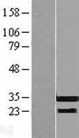 RFPL3 Protein - Western validation with an anti-DDK antibody * L: Control HEK293 lysate R: Over-expression lysate