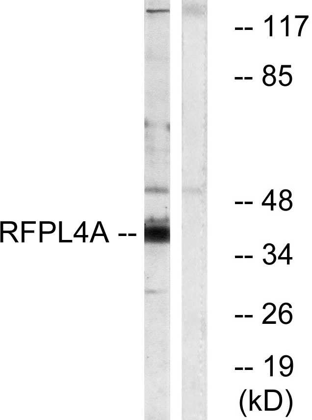 RFPL4A Antibody - Western blot analysis of lysates from HUVEC cells, using RFPL4A Antibody. The lane on the right is blocked with the synthesized peptide.