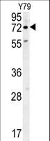 RFT1 Antibody - RFT1 Antibody western blot of Y79 cell line lysates (35 ug/lane). The RFT1 antibody detected the RFT1 protein (arrow).