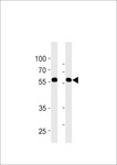 RFTN1 / Raftlin Antibody - RFTN1 Antibody western blot of MDA-MB-231,NCI-H460 cell line lysates (35 ug/lane). The RFTN1 antibody detected the RFTN1 protein (arrow).