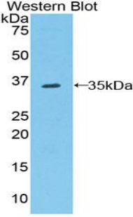 RFTN1 / Raftlin Antibody - Western blot of recombinant RFTN1 / Raftlin.  This image was taken for the unconjugated form of this product. Other forms have not been tested.