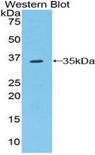 RFTN1 / Raftlin Antibody - Western blot of recombinant RFTN1 / Raftlin.  This image was taken for the unconjugated form of this product. Other forms have not been tested.