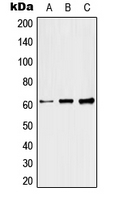 RFTN1 / Raftlin Antibody - Western blot analysis of Raftlin expression in HeLa (A); SP2/0 (B); H9C2 (C) whole cell lysates.
