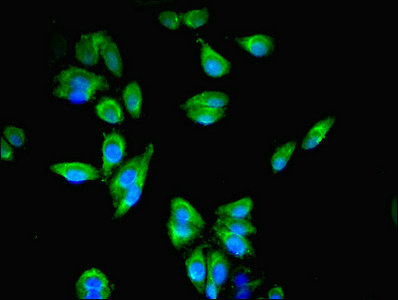 RFTN2 Antibody - Immunofluorescent analysis of HepG2 cells using RFTN2 Antibody at dilution of 1:100 and Alexa Fluor 488-congugated AffiniPure Goat Anti-Rabbit IgG(H+L)