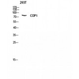 RFWD2 / COP1 Antibody - Western blot of COP1 antibody