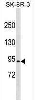 RFWD2 / COP1 Antibody - RFWD2 Antibody western blot of SK-BR-3 cell line lysates (35 ug/lane). The RFWD2 antibody detected the RFWD2 protein (arrow).