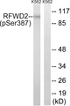 RFWD2 / COP1 Antibody - Western blot analysis of lysates from K562 cells treated with UV 15', using RFWD2 (Phospho-Ser387) Antibody. The lane on the right is blocked with the phospho peptide.