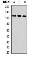 RFWD2 / COP1 Antibody - Western blot analysis of COP1 (pS387) expression in Jurkat UV-treated (A); 293 UV-treated (B); K562 UV-treated (C) whole cell lysates.