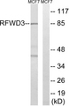RFWD3 Antibody - Western blot analysis of lysates from MCF-7 cells, using RFWD3 Antibody. The lane on the right is blocked with the synthesized peptide.