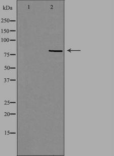 RFWD3 Antibody - Western blot analysis of extracts of MCF-7 cells using RFWD3 antibody. The lane on the left is treated with the antigen-specific peptide.