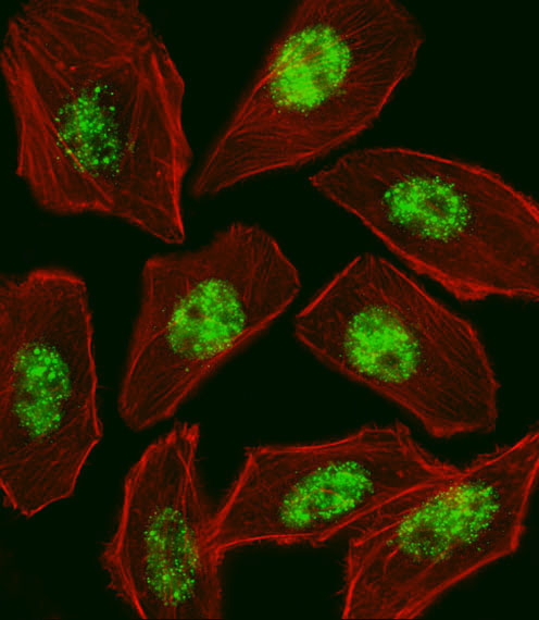 RFX / RFX1 Antibody - Fluorescent image of U251 cell stained with RFX1 Antibody. U251 cells were fixed with 4% PFA (20 min), permeabilized with Triton X-100 (0.1%, 10 min), then incubated with RFX1 primary antibody (1:25, 1 h at 37°C). For secondary antibody, Alexa Fluor 488 conjugated donkey anti-rabbit antibody (green) was used (1:400, 50 min at 37°C). Cytoplasmic actin was counterstained with Alexa Fluor 555 (red) conjugated Phalloidin (7units/ml, 1 h at 37°C). RFX1 immunoreactivity is localized to Nucleus significantly.