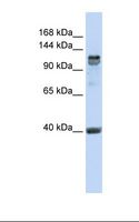RFX / RFX1 Antibody - MCF7 cell lysate. Antibody concentration: 1.0 ug/ml. Gel concentration: 6-18%.  This image was taken for the unconjugated form of this product. Other forms have not been tested.