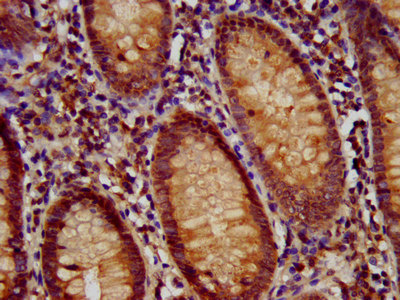 RFX / RFX1 Antibody - Immunohistochemistry image at a dilution of 1:700 and staining in paraffin-embedded human appendix tissue performed on a Leica BondTM system. After dewaxing and hydration, antigen retrieval was mediated by high pressure in a citrate buffer (pH 6.0) . Section was blocked with 10% normal goat serum 30min at RT. Then primary antibody (1% BSA) was incubated at 4 °C overnight. The primary is detected by a biotinylated secondary antibody and visualized using an HRP conjugated SP system.