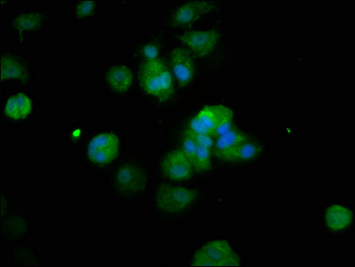 RFX2 Antibody - Immunofluorescence staining of MCF-7 cells at a dilution of 1:200, counter-stained with DAPI. The cells were fixed in 4% formaldehyde, permeabilized using 0.2% Triton X-100 and blocked in 10% normal Goat Serum. The cells were then incubated with the antibody overnight at 4 °C.The secondary antibody was Alexa Fluor 488-congugated AffiniPure Goat Anti-Rabbit IgG (H+L) .