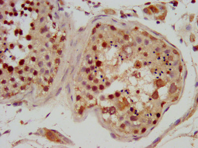RFX2 Antibody - IHC image of RFX2 Antibody diluted at 1:600 and staining in paraffin-embedded human testis tissue performed on a Leica BondTM system. After dewaxing and hydration, antigen retrieval was mediated by high pressure in a citrate buffer (pH 6.0). Section was blocked with 10% normal goat serum 30min at RT. Then primary antibody (1% BSA) was incubated at 4°C overnight. The primary is detected by a biotinylated secondary antibody and visualized using an HRP conjugated SP system.
