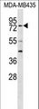 RFX3 Antibody - RFX3 Antibody western blot of MDA-MB435 cell line lysates (35 ug/lane). The RFX3 antibody detected the RFX3 protein (arrow).