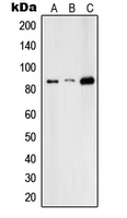 RFX3 Antibody - Western blot analysis of RFX3 expression in HepG2 (A); Raw264.7 (B); H9C2 (C) whole cell lysates.