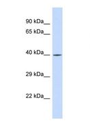 RFX3 Antibody - Western blot of Human HeLa. RFX3 antibody dilution 1.0 ug/ml.  This image was taken for the unconjugated form of this product. Other forms have not been tested.