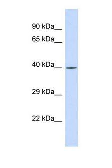 RFX3 Antibody - Western blot of Human HeLa. RFX3 antibody dilution 1.0 ug/ml.  This image was taken for the unconjugated form of this product. Other forms have not been tested.