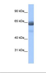 RFX4 Antibody - Fetal lung cell lysate. Antibody concentration: 0.5 ug/ml. Gel concentration: 8%.  This image was taken for the unconjugated form of this product. Other forms have not been tested.
