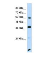RFX4 Antibody - Western blot of Human Transfected 293T. RFX4 antibody dilution 1.0 ug/ml.  This image was taken for the unconjugated form of this product. Other forms have not been tested.