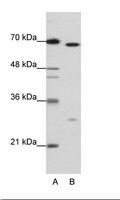 RFX4 Antibody - A: Marker, B: HepG2 Cell Lysate.  This image was taken for the unconjugated form of this product. Other forms have not been tested.