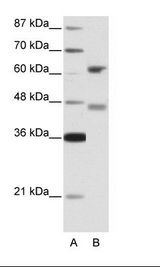 RFX4 Antibody - A: Marker, B: 293T Cell Lysate.  This image was taken for the unconjugated form of this product. Other forms have not been tested.