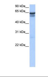 RFX5 Antibody - 721_B cell lysate. Antibody concentration: 2.0 ug/ml. Gel concentration: 12%.  This image was taken for the unconjugated form of this product. Other forms have not been tested.