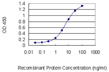 RFX5 Antibody - Detection limit for recombinant GST tagged RFX5 is 0.1 ng/ml as a capture antibody.