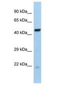 RFX6 Antibody - RFX6 antibody Western Blot of Mouse Liver. Antibody dilution: 1 ug/ml.  This image was taken for the unconjugated form of this product. Other forms have not been tested.