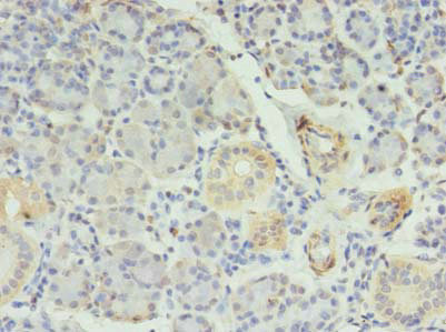 RFX6 Antibody - Immunohistochemistry of paraffin-embedded human pancreatic tissue using RFX6 Antibody at dilution of 1:100