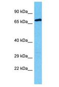 RFX8 Antibody - RFX8 antibody Western Blot of HT1080. Antibody dilution: 1 ug/ml.  This image was taken for the unconjugated form of this product. Other forms have not been tested.