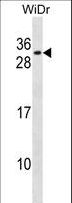 RFXANK Antibody - RFXANK Antibody western blot of WiDr cell line lysates (35 ug/lane). The RFXANK antibody detected the RFXANK protein (arrow).