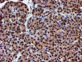 RFXANK Antibody - IHC of paraffin-embedded Human pancreas tissue using anti-RFXANK mouse monoclonal antibody.