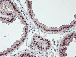 RFXANK Antibody - IHC of paraffin-embedded Human breast tissue using anti-RFXANK mouse monoclonal antibody.