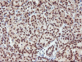 RFXANK Antibody - IHC of paraffin-embedded Human pancreas tissue using anti-RFXANK mouse monoclonal antibody.
