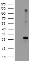 RFXANK Antibody - HEK293T cells were transfected with the pCMV6-ENTRY control (Left lane) or pCMV6-ENTRY RFXANK (Right lane) cDNA for 48 hrs and lysed. Equivalent amounts of cell lysates (5 ug per lane) were separated by SDS-PAGE and immunoblotted with anti-RFXANK.