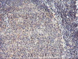 RFXANK Antibody - IHC of paraffin-embedded Human tonsil using anti-RFXANK mouse monoclonal antibody. (Heat-induced epitope retrieval by 10mM citric buffer, pH6.0, 100C for 10min).