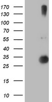RFXANK Antibody - HEK293T cells were transfected with the pCMV6-ENTRY control (Left lane) or pCMV6-ENTRY RFXANK (Right lane) cDNA for 48 hrs and lysed. Equivalent amounts of cell lysates (5 ug per lane) were separated by SDS-PAGE and immunoblotted with anti-RFXANK.