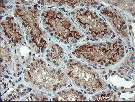 RFXANK Antibody - IHC of paraffin-embedded Human Kidney tissue using anti-RFXANK mouse monoclonal antibody. (Heat-induced epitope retrieval by 10mM citric buffer, pH6.0, 100C for 10min).