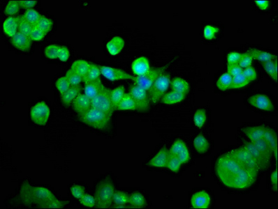 RFXANK Antibody - Immunofluorescence staining of PC3 cells at a dilution of 1:133, counter-stained with DAPI. The cells were fixed in 4% formaldehyde, permeabilized using 0.2% Triton X-100 and blocked in 10% normal Goat Serum. The cells were then incubated with the antibody overnight at 4 °C.The secondary antibody was Alexa Fluor 488-congugated AffiniPure Goat Anti-Rabbit IgG (H+L) .