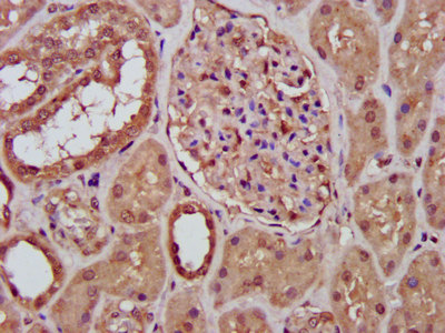 RFXANK Antibody - Immunohistochemistry image at a dilution of 1:400 and staining in paraffin-embedded human kidney tissue performed on a Leica BondTM system. After dewaxing and hydration, antigen retrieval was mediated by high pressure in a citrate buffer (pH 6.0) . Section was blocked with 10% normal goat serum 30min at RT. Then primary antibody (1% BSA) was incubated at 4 °C overnight. The primary is detected by a biotinylated secondary antibody and visualized using an HRP conjugated SP system.