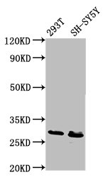 RFXANK Antibody - Positive Western Blot detected in 293T whole cell lysate, SH-SY5Y whole cell lysate. All lanes: RFXANK antibody at 6.7 µg/ml Secondary Goat polyclonal to rabbit IgG at 1/50000 dilution. Predicted band size: 29, 25, 26 KDa. Observed band size: 29 KDa