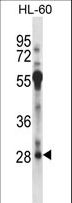 RFXAP Antibody - RFXAP Antibody western blot of HL-60 cell line lysates (35 ug/lane). The RFXAP antibody detected the RFXAP protein (arrow).