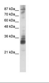 RG9MTD2 Antibody - HepG2 Cell Lysate.  This image was taken for the unconjugated form of this product. Other forms have not been tested.