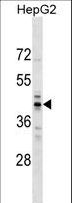 RG9MTD2 Antibody - RG9MTD2 Antibody western blot of HepG2 cell line lysates (35 ug/lane). The RG9MTD2 antibody detected the RG9MTD2 protein (arrow).