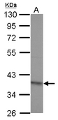 RG9MTD2 Antibody - Sample (30 ug of whole cell lysate) A: NT2D1 10% SDS PAGE RG9MTD2 antibody diluted at 1:1000