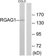 RGAG1 Antibody - Western blot analysis of lysates from COLO cells, using RGAG1 Antibody. The lane on the right is blocked with the synthesized peptide.